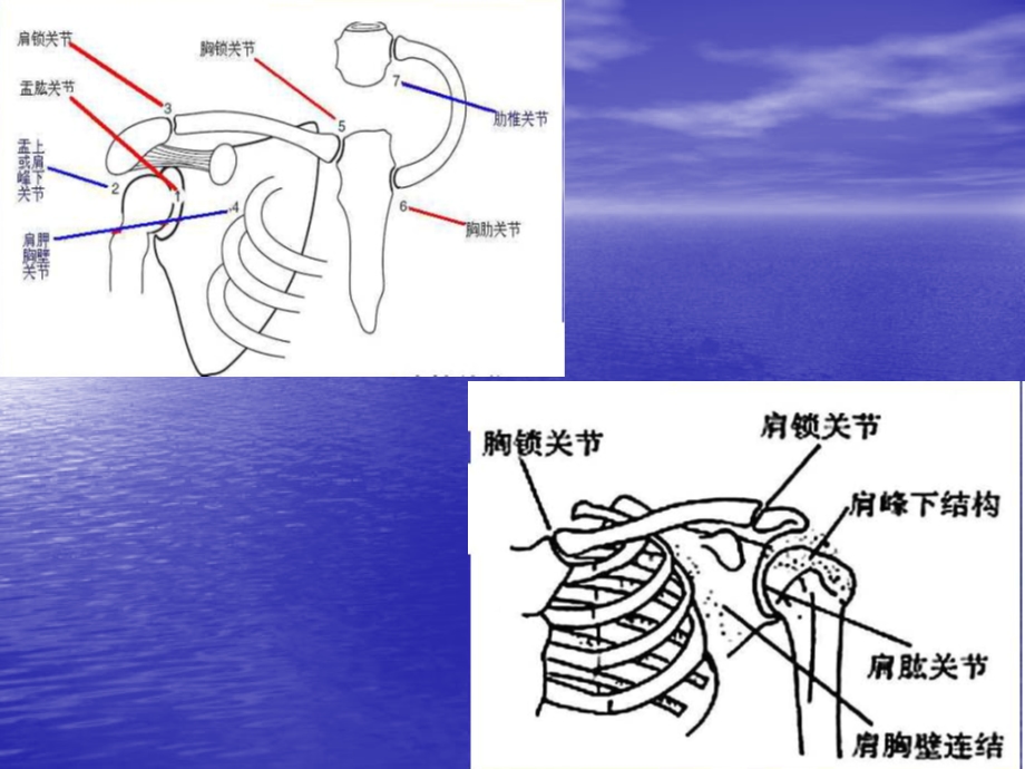 偏瘫患者的常见肩.ppt_第3页