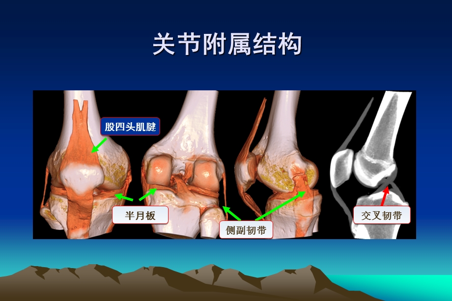 关节置换的康复(髋关节).ppt_第3页