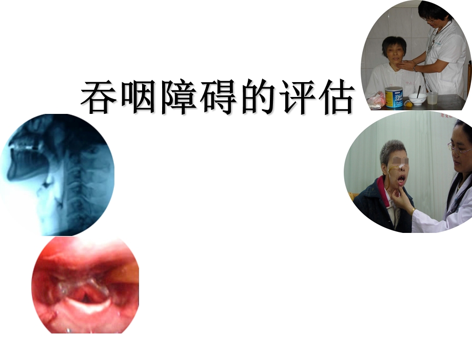 吞咽障碍的评估.ppt_第1页