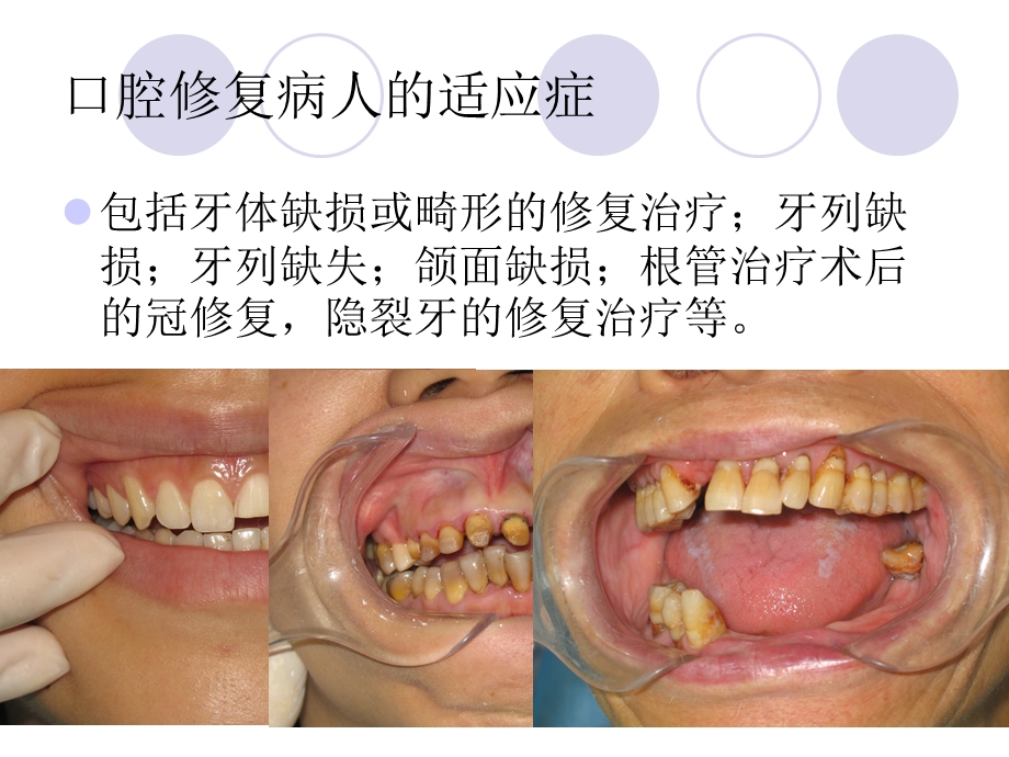 口腔修复病人的基础护理.ppt_第2页