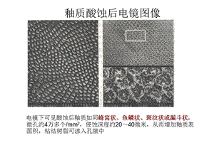 口腔粘结修复技术2.ppt