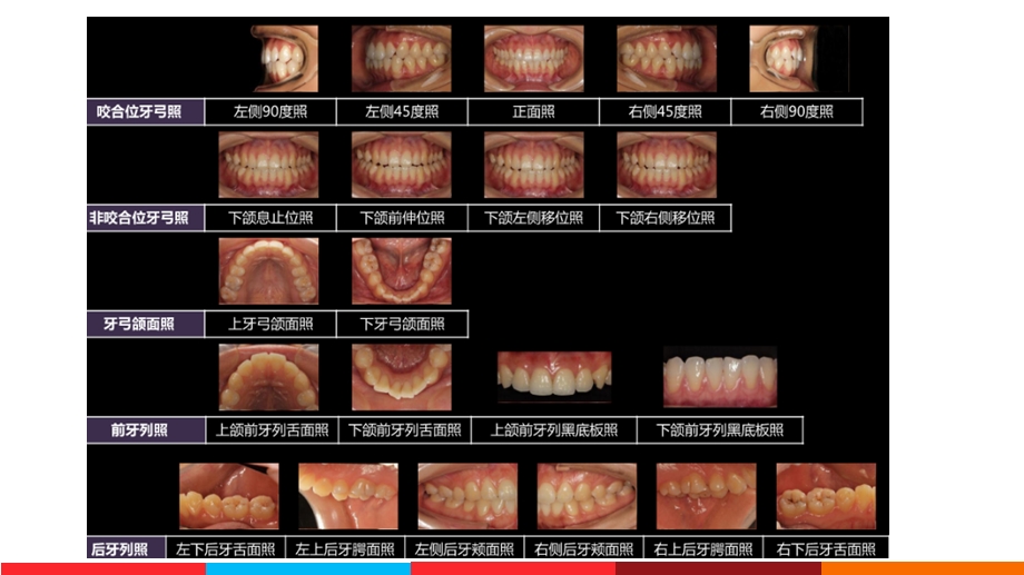 口腔医学美学第三章 口腔摄影.ppt_第3页