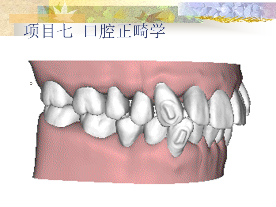 口腔正畸学概述..ppt_第2页