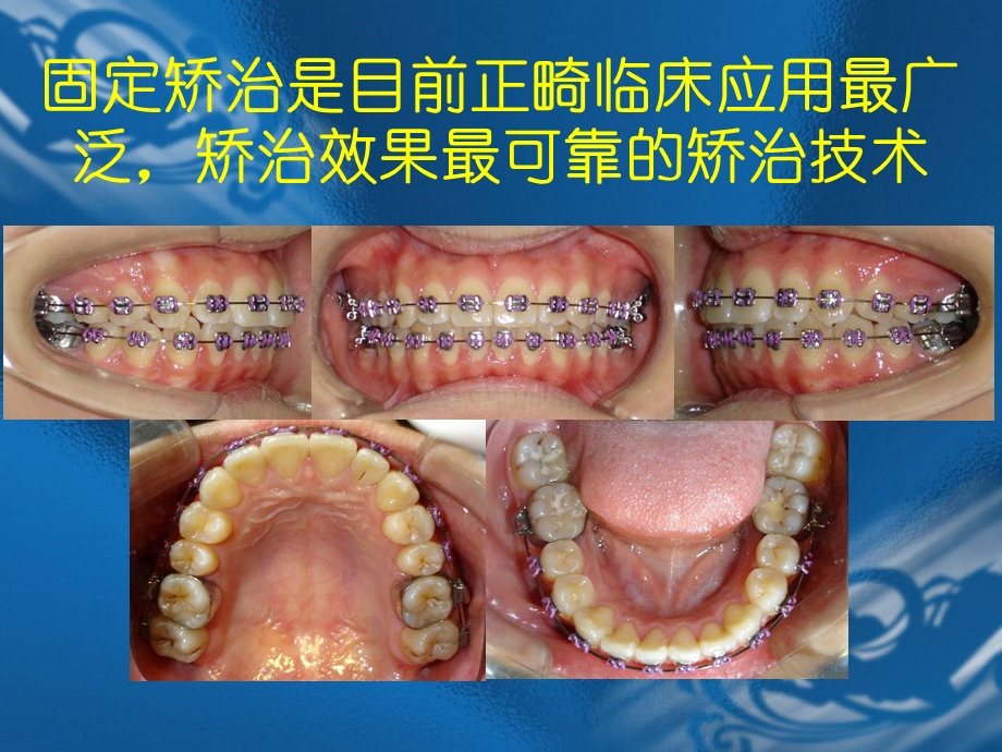 口腔正畸学.ppt_第2页