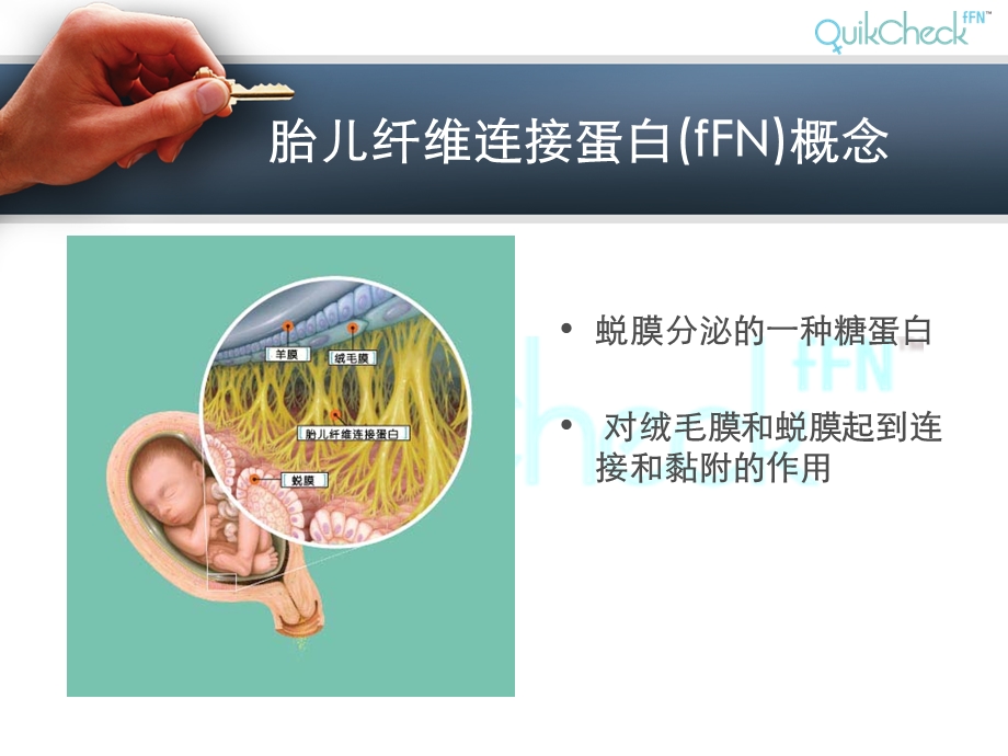 fFN临床应用.ppt_第2页