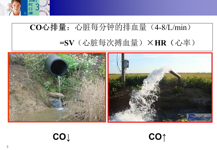 PiCCO参数的临床意义.ppt_第3页