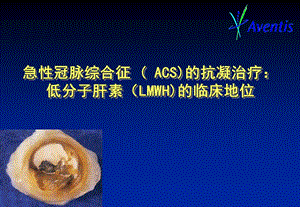 【精美医学课件】急性冠脉综合征(ACS)的抗凝治疗低分子肝素(LMWH)的临床地位.ppt