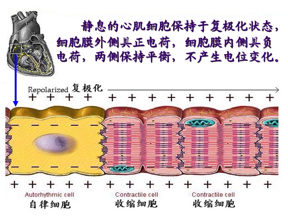 【培训课件】临床心电图学教程.ppt_第3页