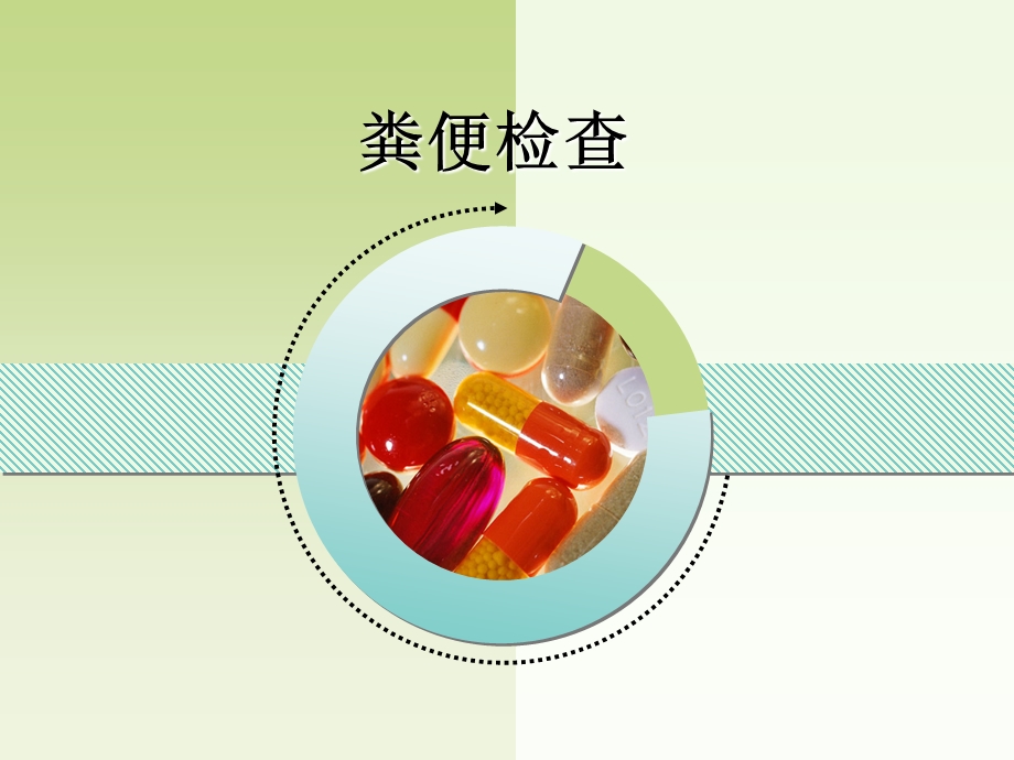 第4章其他排泄物和体腔液检查.ppt_第1页