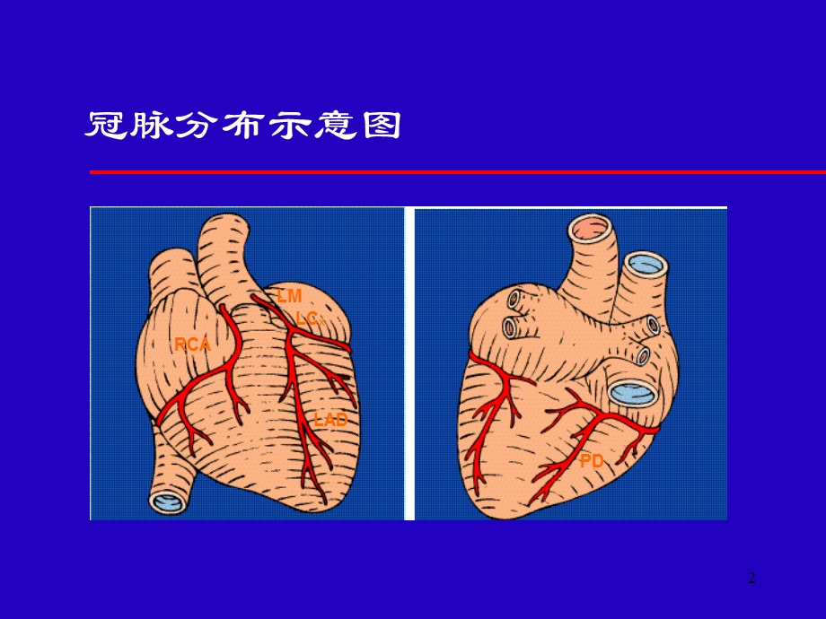 IABP讲义(程锐) (PPTminimizer)2.ppt_第2页