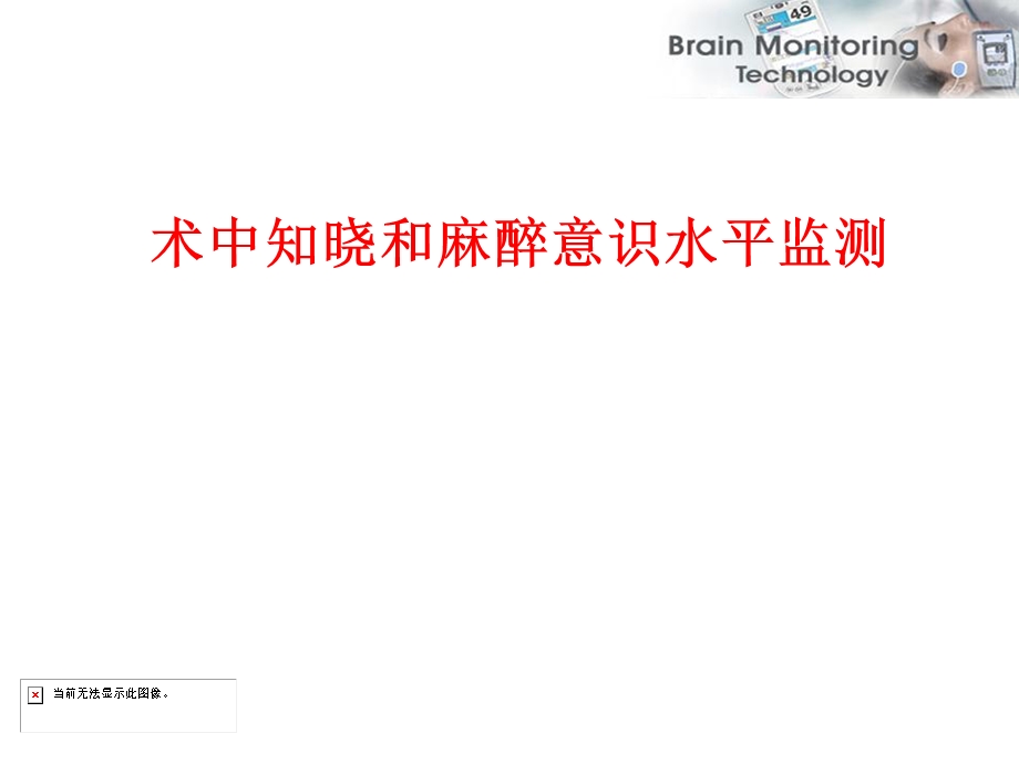 术中知晓和麻醉监测.ppt_第1页