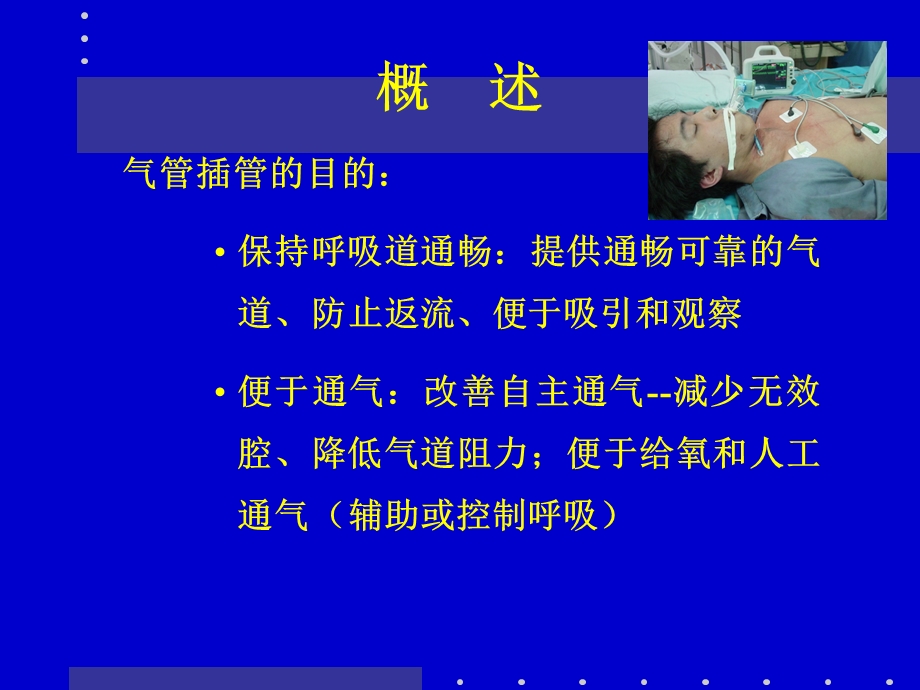 气管插管术1.ppt_第2页