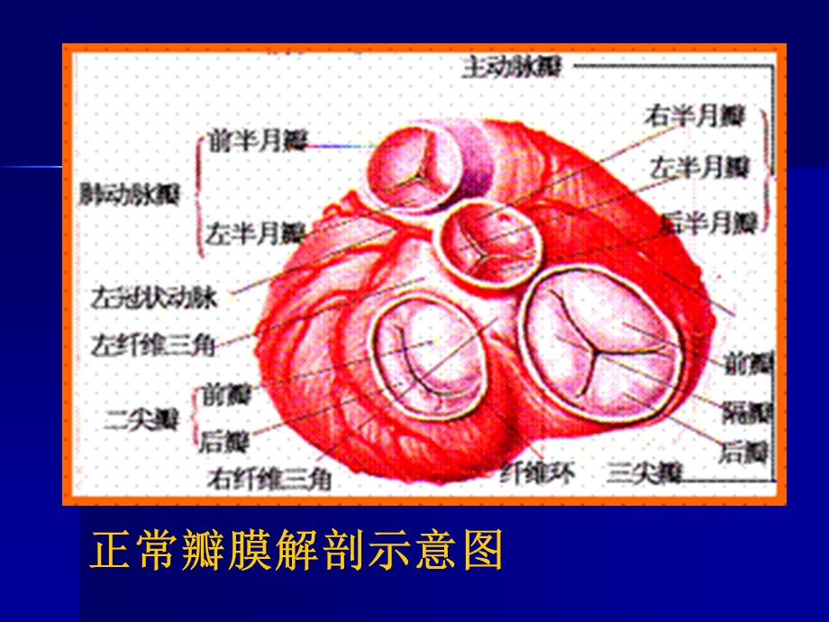 第四节风心病.ppt_第2页