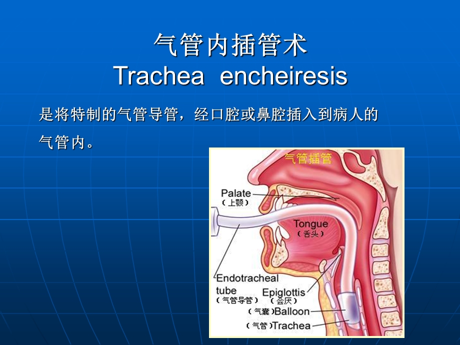 气管插管术.ppt.ppt_第3页