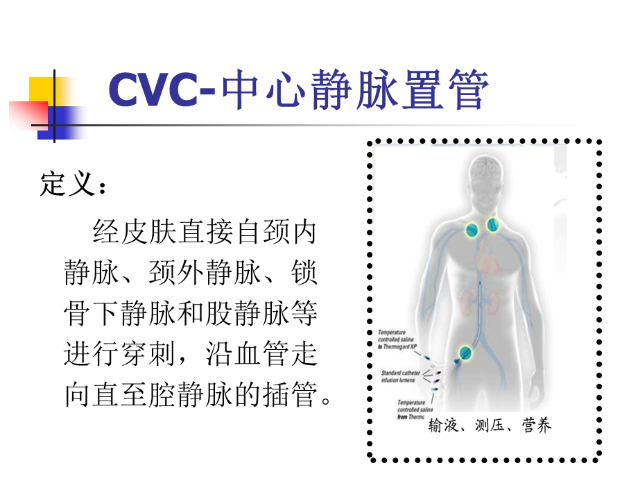 中心静脉置管的相关知识.ppt_第3页