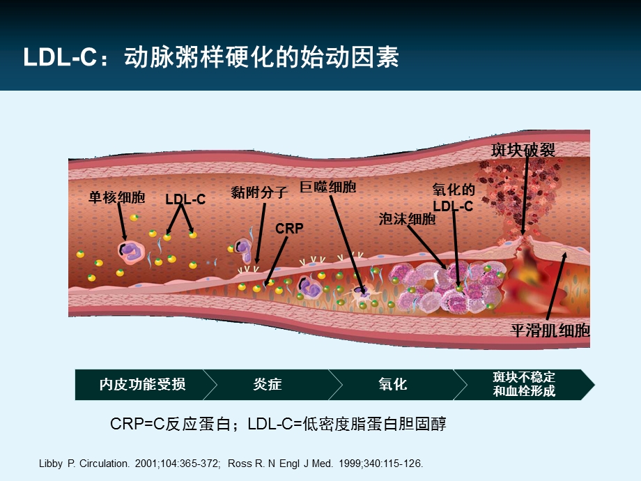 他汀在颈动脉粥样硬化中的证据.ppt_第2页