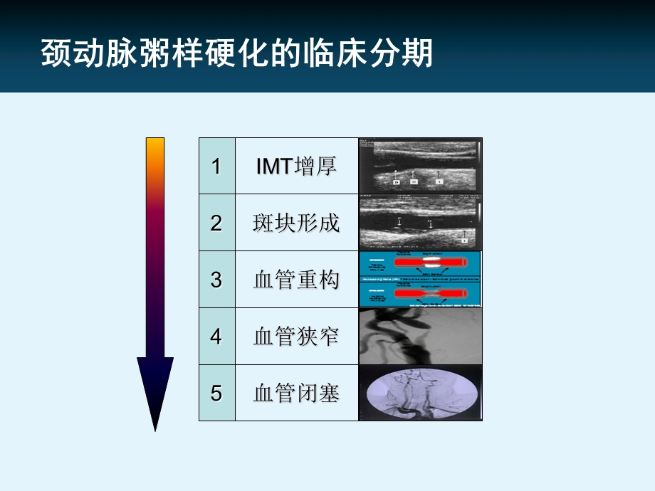 他汀在颈动脉粥样硬化中的证据.ppt_第3页