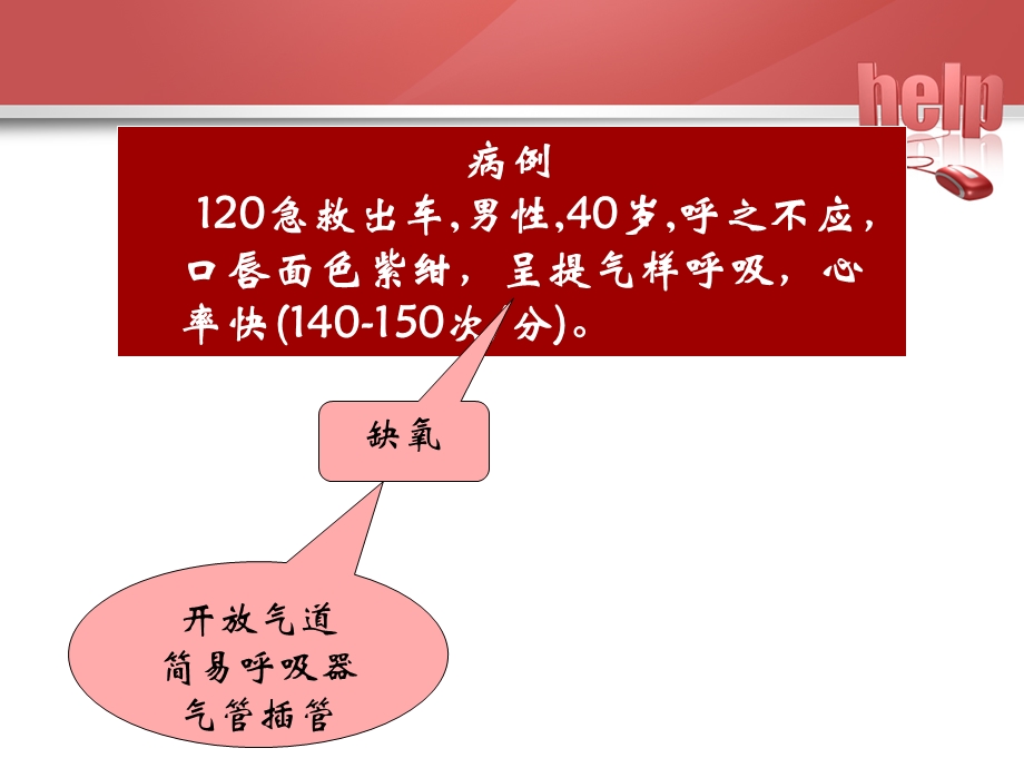 气管插管的医护配合.ppt_第2页