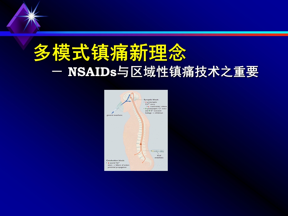 多模式镇痛新理念.ppt_第1页