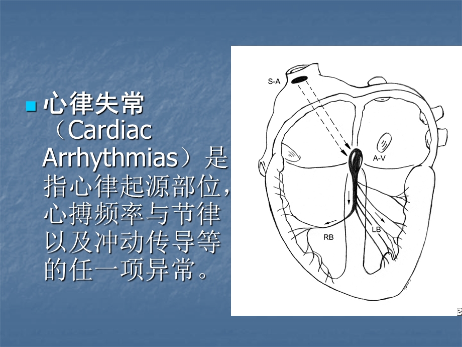 第5节心律失常名师编辑PPT课件.ppt_第2页