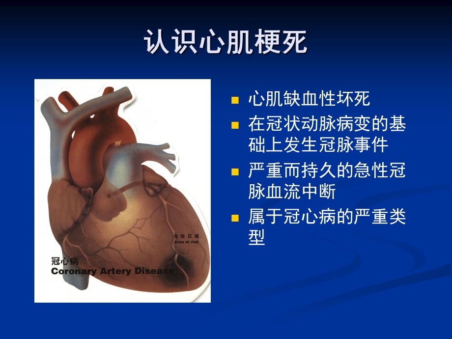 心肌梗死的防治.ppt_第2页