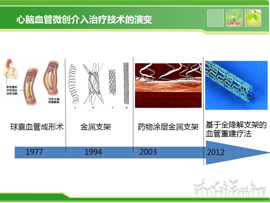 生物可降解血管支架的研究现状.ppt_第3页