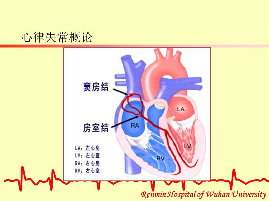 心律失常的防治.ppt_第3页