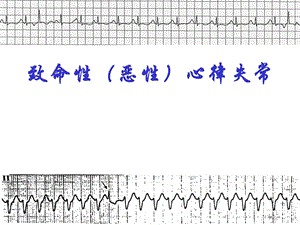 恶性心律失常课件.ppt