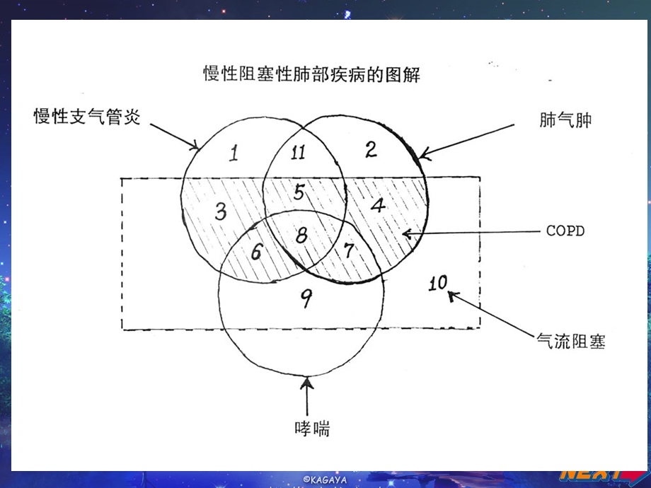 慢性阻塞性肺疾病中医治疗.ppt_第2页