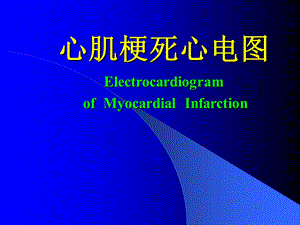 心肌梗死心电图.ppt