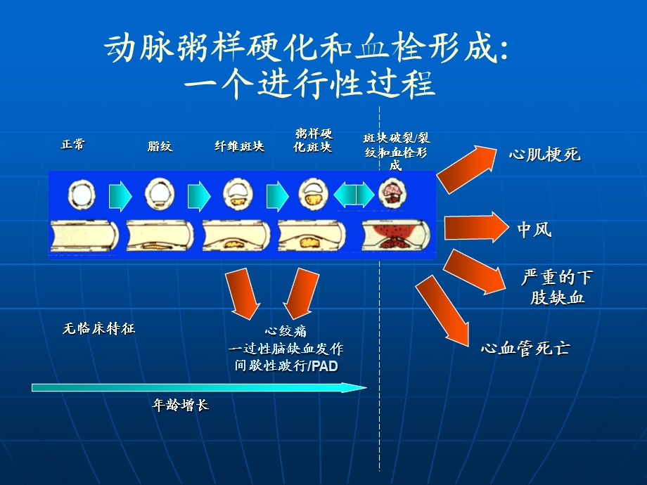 泰嘉硫酸氢氯吡格雷.ppt_第3页