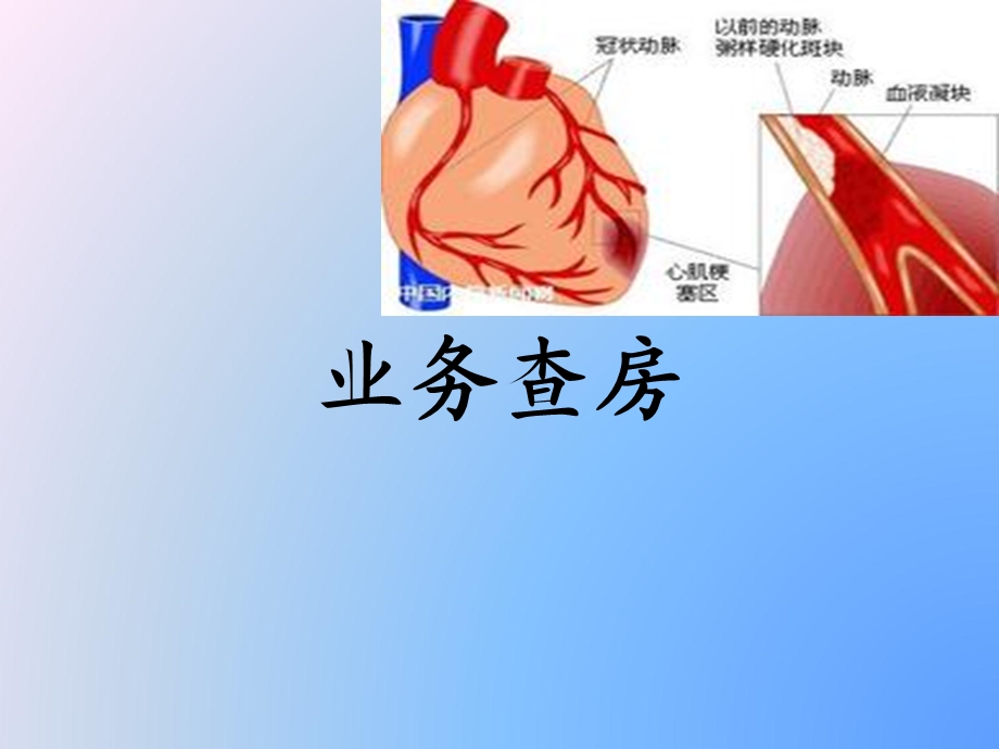 扩张性心肌病.ppt_第1页