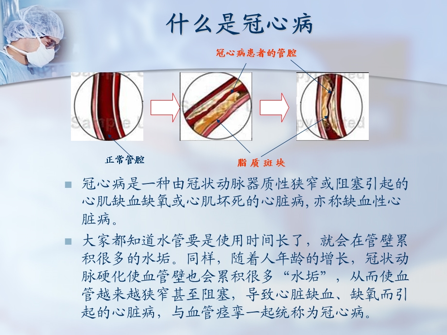 社区健康讲座PPT冠心病心绞痛的防治.ppt_第2页