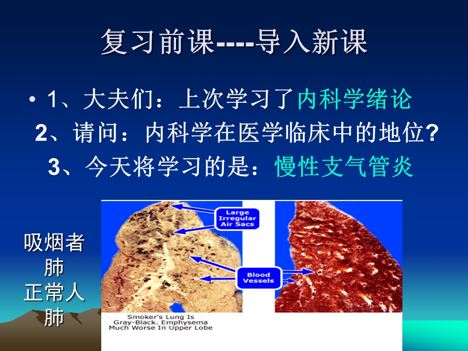 慢支、COPD、肺心病.ppt_第2页