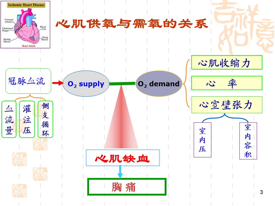 心绞痛小讲课.ppt_第3页