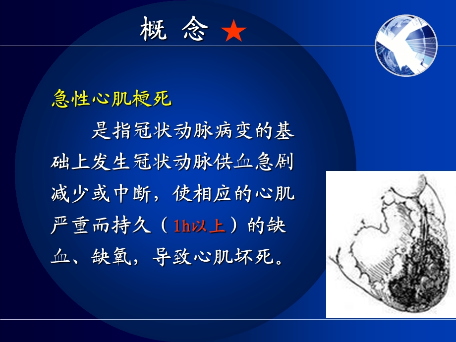 心肌梗死心肌梗塞心梗.ppt_第3页