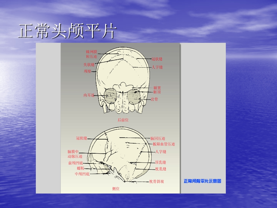 神经外科见习教学图片.ppt_第2页