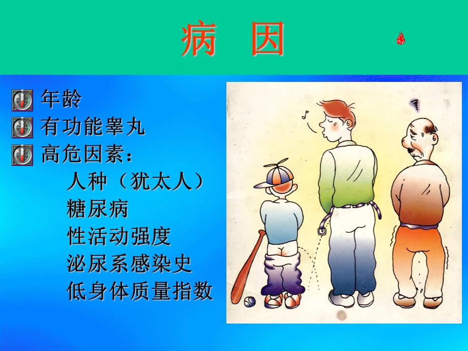 良性前列腺增生ppt.ppt_第2页