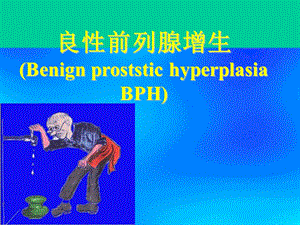 良性前列腺增生ppt.ppt