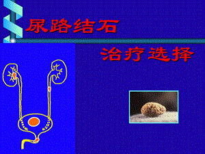 尿路结石治疗选择.ppt