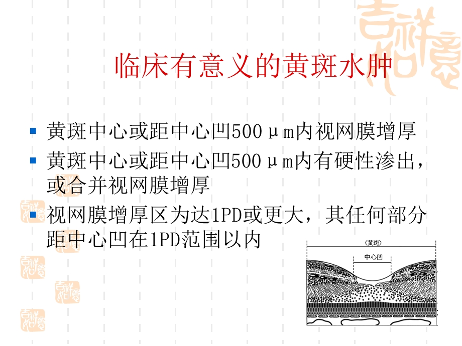 糖尿病性黄斑水肿.ppt_第3页