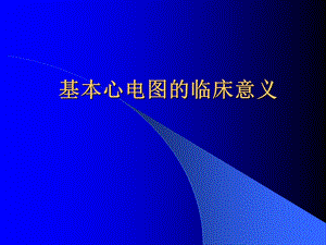 心电图岗前培训PPT幻灯片.ppt