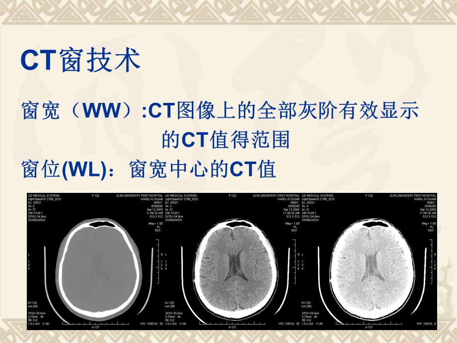 头部CT基础及断面解剖.ppt_第3页