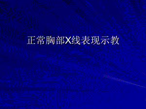 正常胸部X线表现.ppt