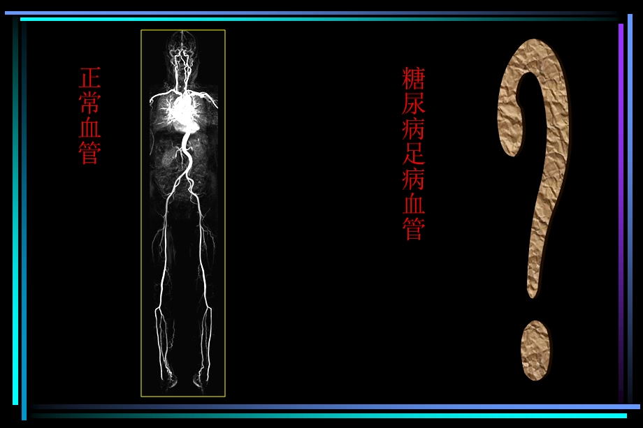 CEMRA对糖尿病足血管病变的诊断价值.ppt_第2页