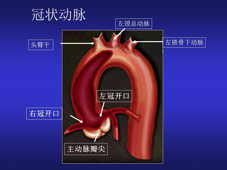 冠脉造影与介入治疗中理想投照角度的选择.ppt_第3页