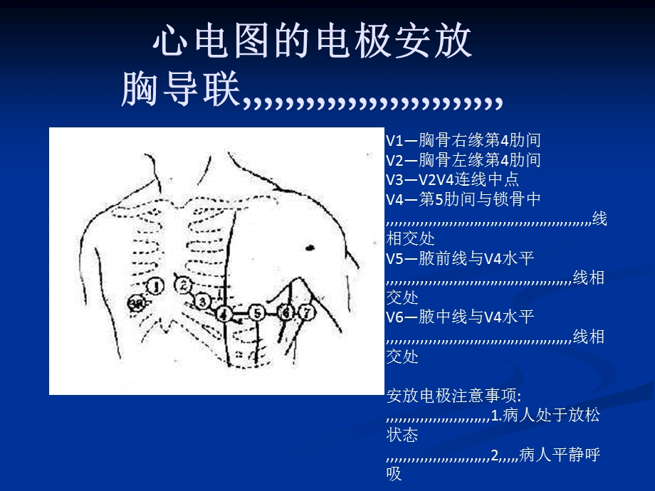 [整理版]心电图,三基培训.ppt_第2页