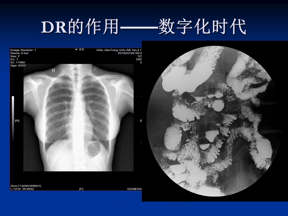 影像学的艺术与哲学讲课稿.ppt_第3页