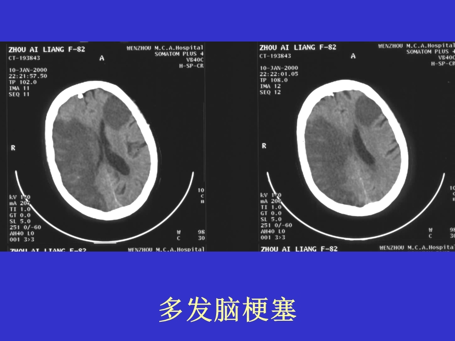 CT实习片.ppt_第2页