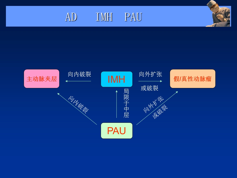 主动脉夹层、壁间血肿及穿通性溃疡.ppt_第3页